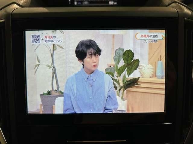 SUBARU XV 2018 Image 31